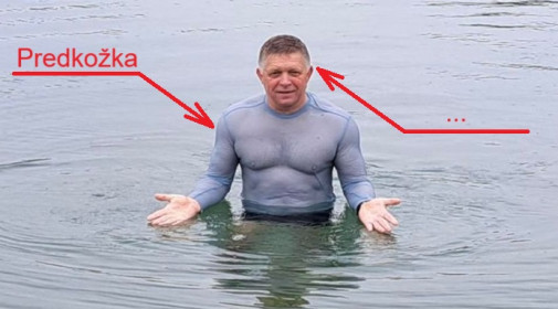 Doplňovačka z anatómie